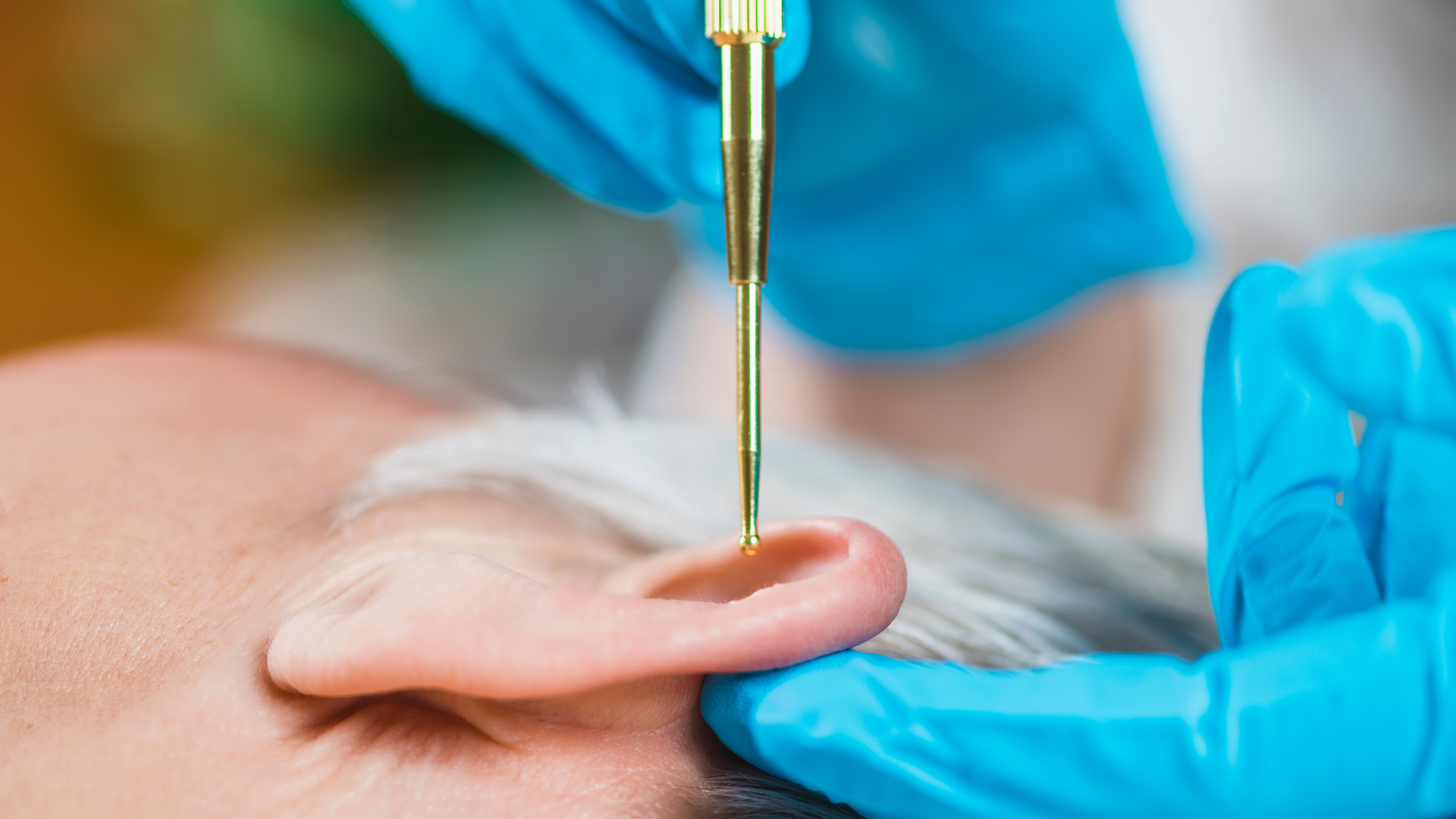Auricular Acupressure Magnetic Seeds
